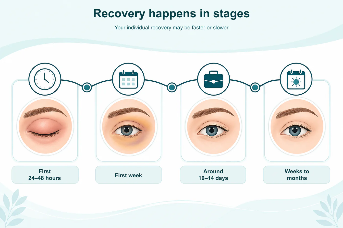 Infographic showing the stages of recovery after eyelid surgery